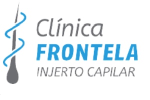 Clínica Frontela es de las mejores clínicas de injerto capilar en Sevilla