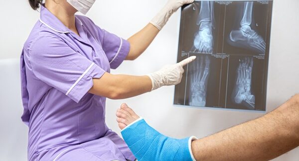 Osteoporosis - Médico especialista observando las fracturas de un paciente debido a la pérdida de masa ósea en uno de los mejores centros de osteoporosis de Sevilla