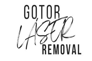 Gotor Láser Removal