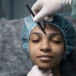 en una de las clínicas de rinoplastia, un especialista marca el área de la nariz de una paciente, quien se va a realizar este procedimiento