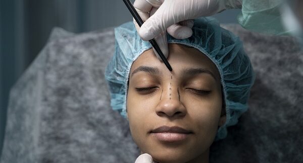 en una de las clínicas de rinoplastia, un especialista marca el área de la nariz de una paciente, quien se va a realizar este procedimiento